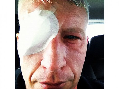 Anderson Cooper Blind Instagram Anderson Cooper Sofreu Lesões Nos Olhos Em Portugal