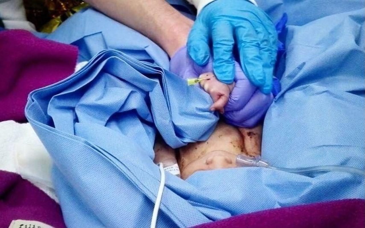 Bebe Covid-19: Nasceu O Segundo Bebé De Mãe Infetada Em Portugal